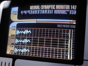 Filename=extant_StarTrek_VOY_6x26-UnimatrixZeroPart1_01734.jpg
Filesize=236KiB
Dimensions=1200x900
Date added=Jan 03, 2020 extant_StarTrek_VOY_6x26-UnimatrixZeroPart1_01734.jpg