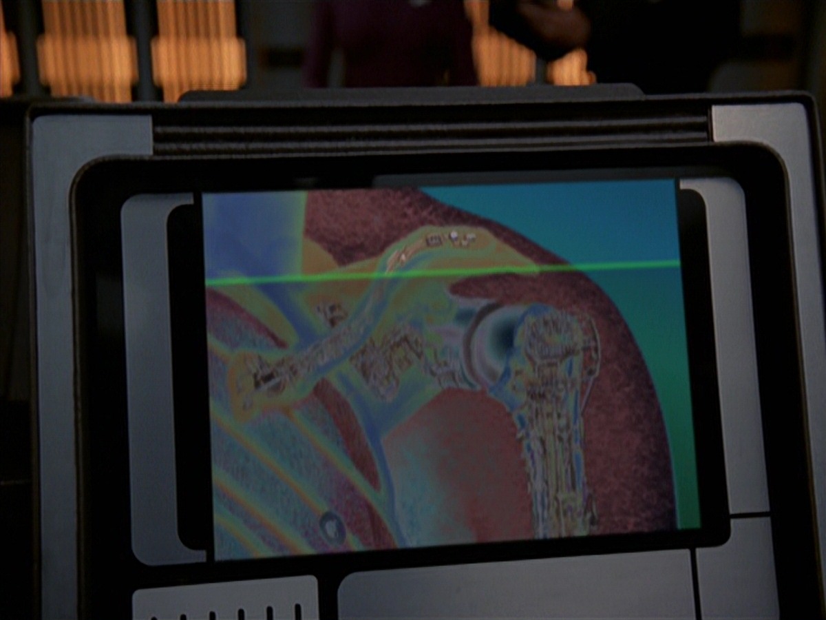 extant_StarTrek_VOY_7x18-HumanError_0846.jpg