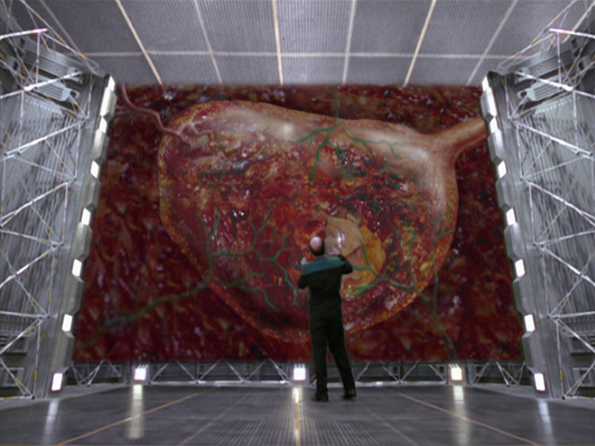 extant_StarTrek_VOY_5x08-NothingHuman_00080.jpg