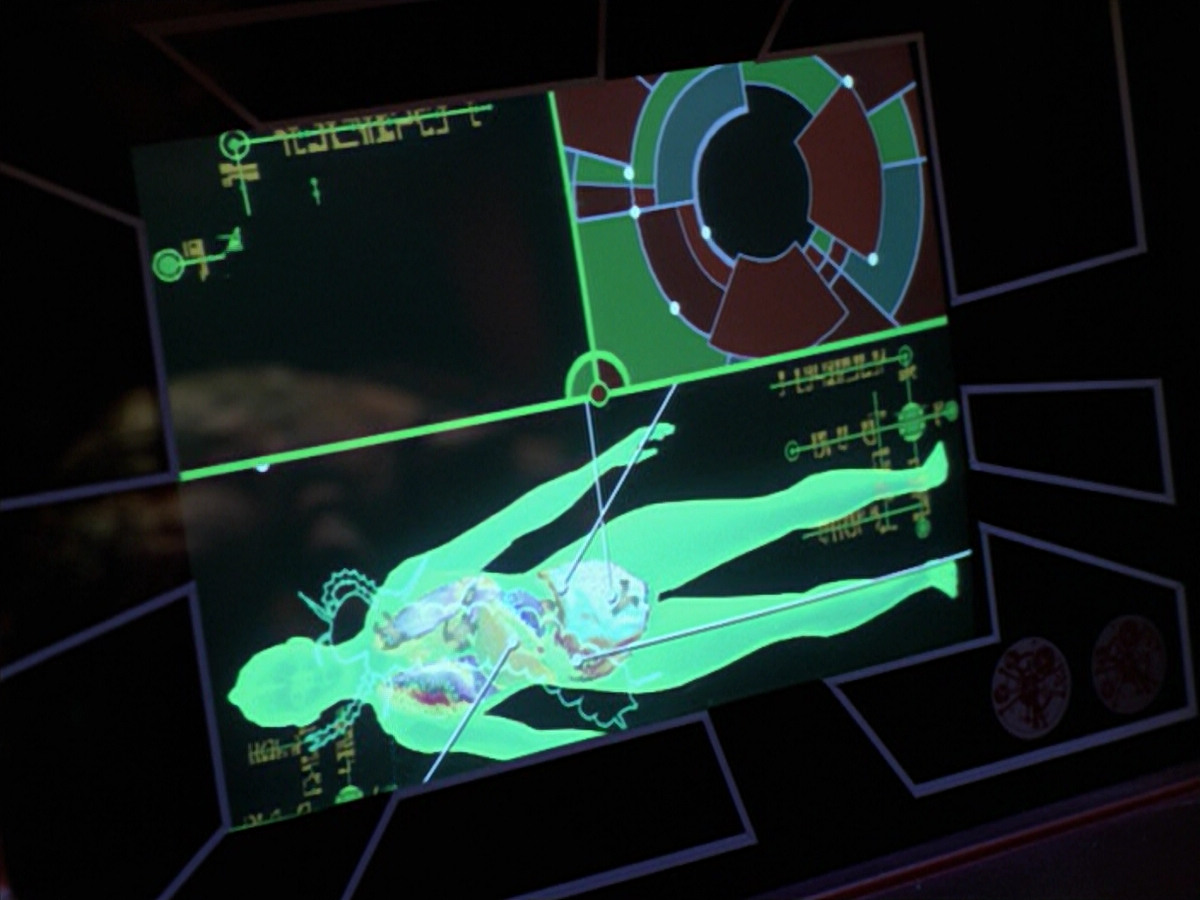 extant_StarTrek_VOY_5x08-NothingHuman_02943.jpg