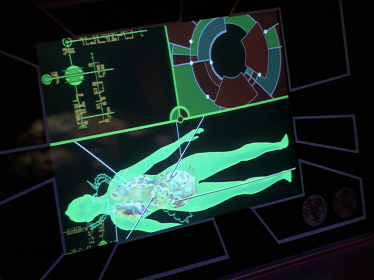 extant_StarTrek_VOY_5x08-NothingHuman_02944.jpg