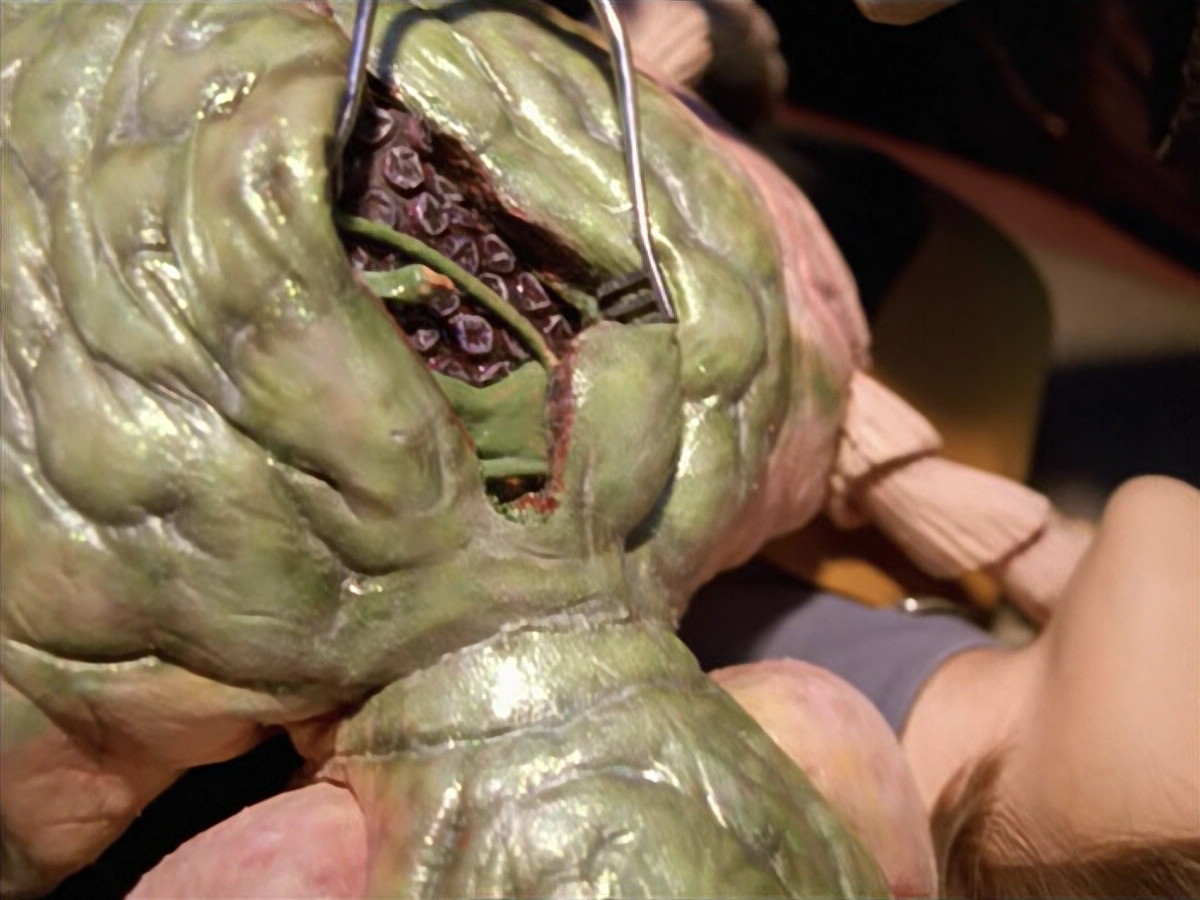 extant_StarTrek_VOY_5x08-NothingHuman_03083.jpg