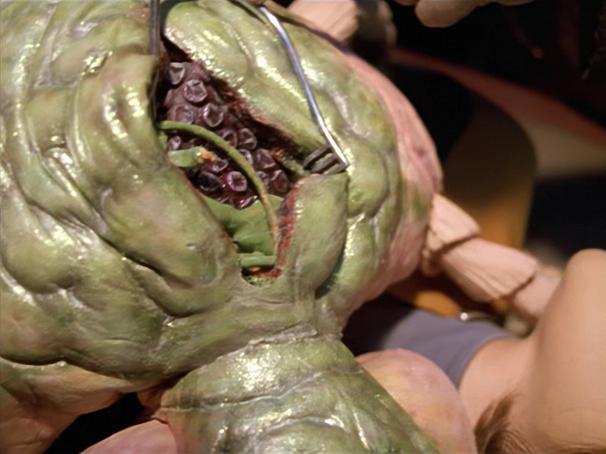extant_StarTrek_VOY_5x08-NothingHuman_03085.jpg