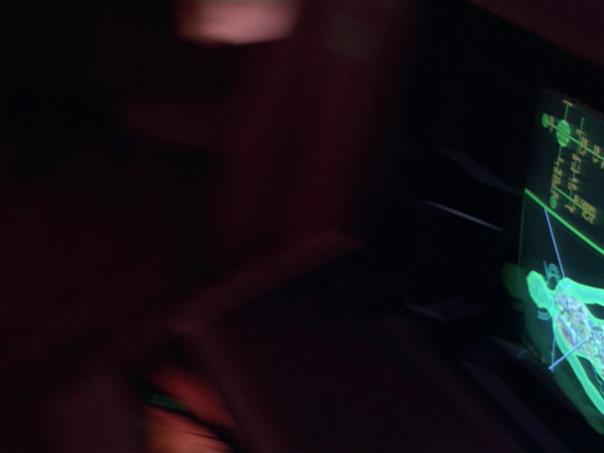extant_StarTrek_VOY_5x08-NothingHuman_03258.jpg