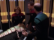 extant_StarTrek_VOY_5x08-NothingHuman_00650.jpg